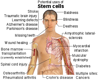 stem-cell-uses.png